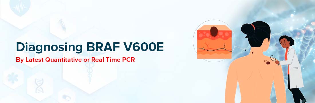 Diagnosing BRAF V600E By Latest Quantitative or Real Time PCR